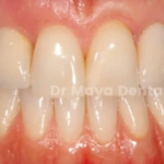 Understanding The Best Aesthetic Dentistry Solutions